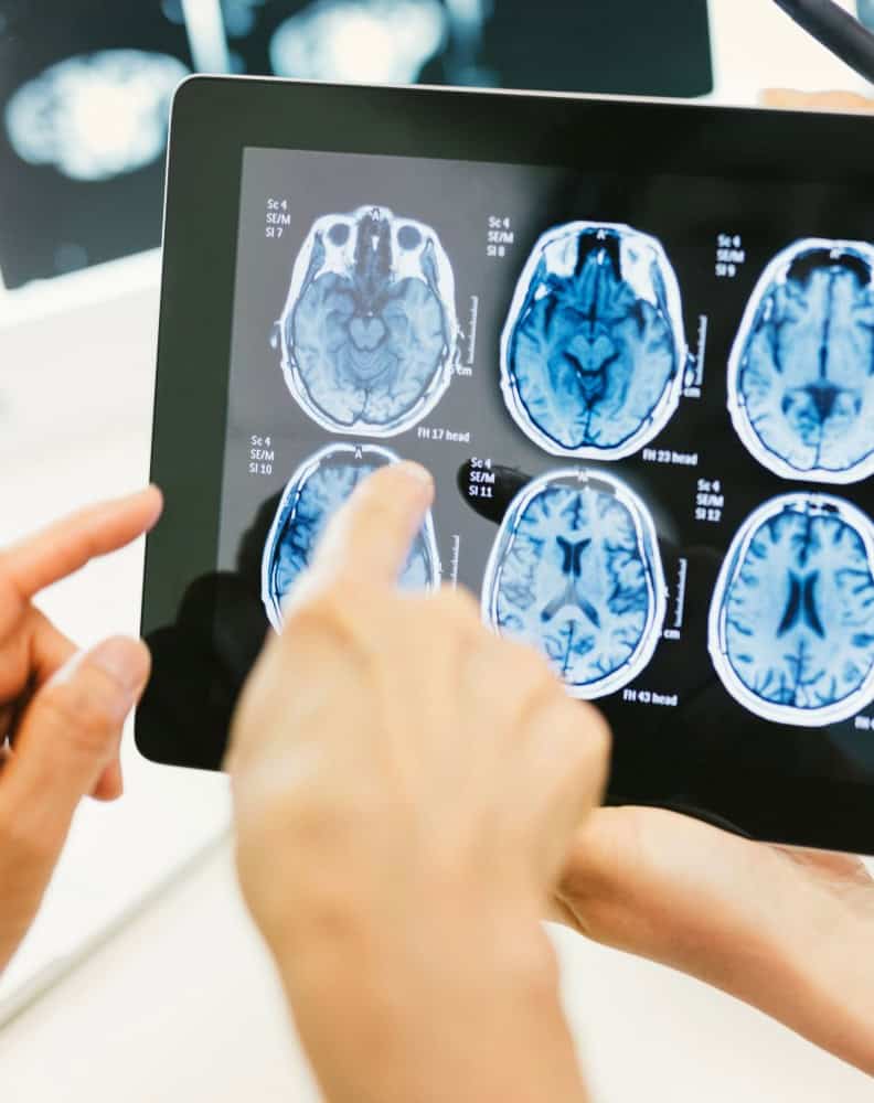 handheld tablet showing CT scan results with the help of teleradiology and image distribution of medical imaging system and the other person is pointing at the result