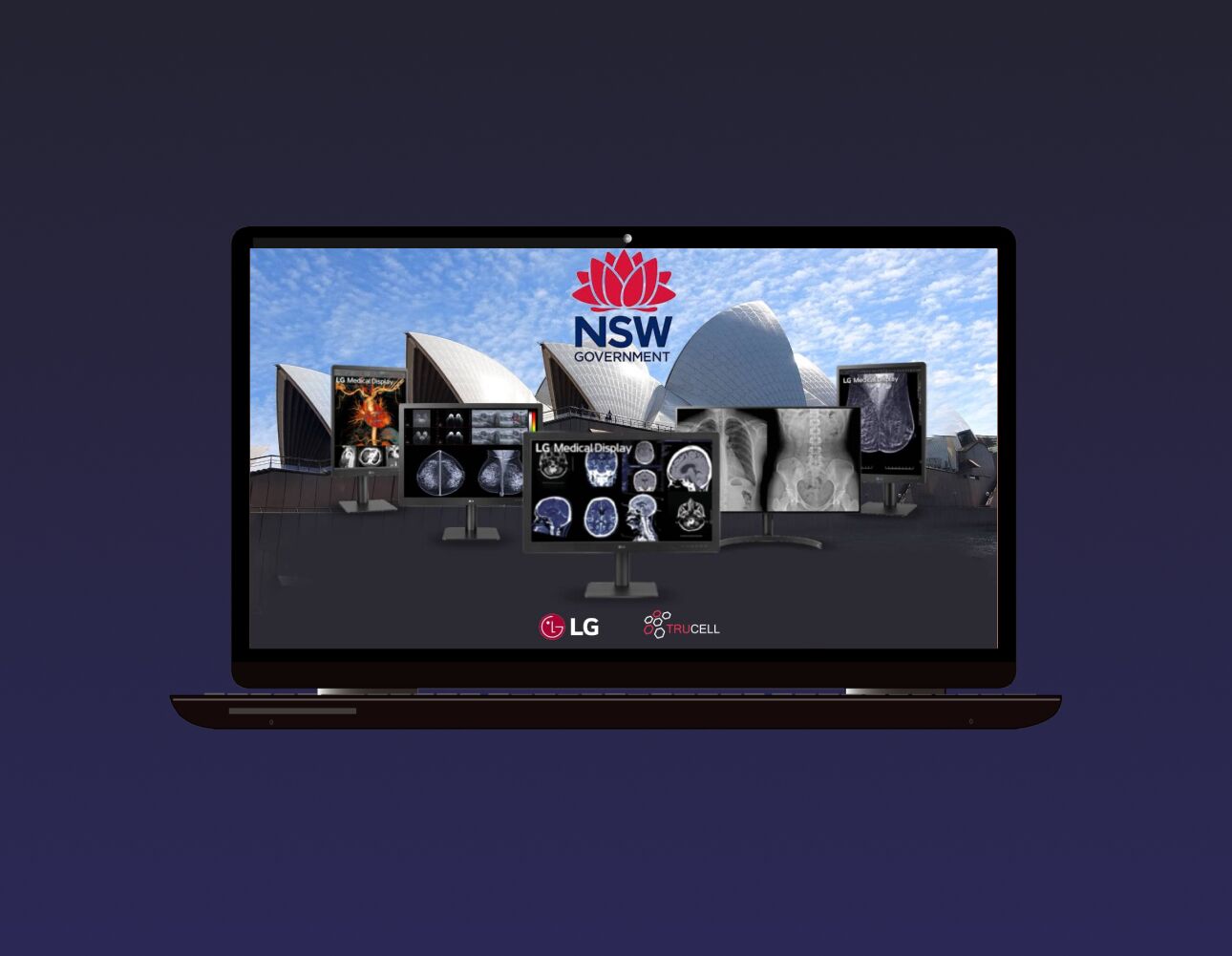 laptop showing LG Medical Monitors is showcased having Sydney Opera House at the background